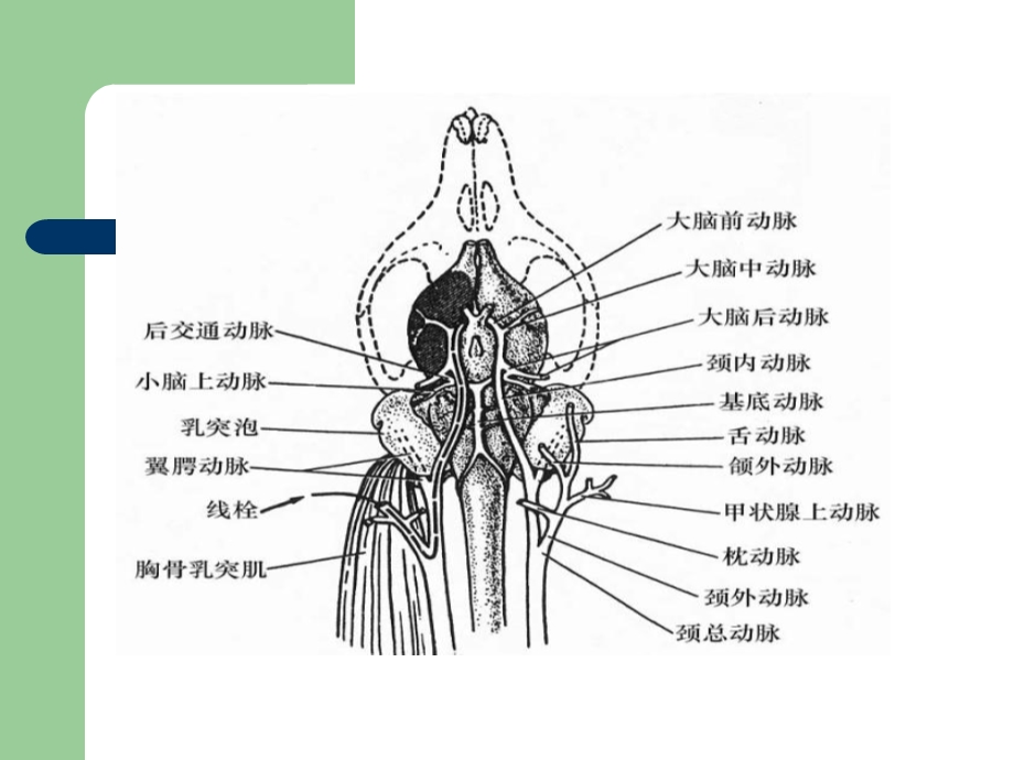 鼠MCAO模型的制.ppt_第3页