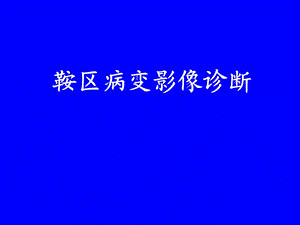 鞍区病变影像诊断(上).ppt