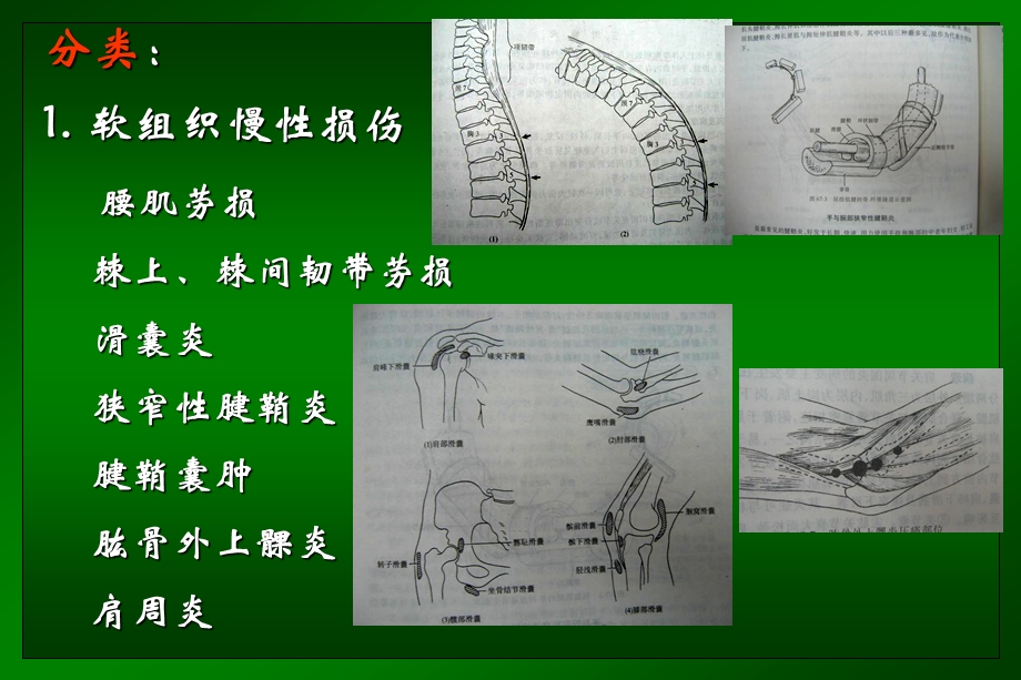 运动系统畸形培训课件.ppt_第3页