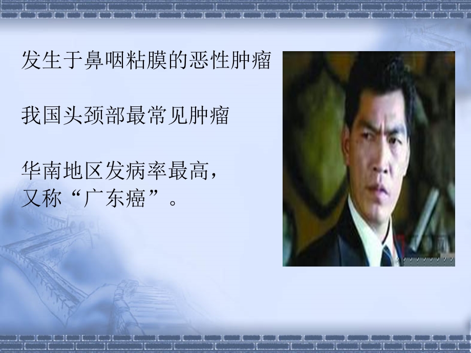 鼻咽癌诊治 彭小波.ppt_第2页