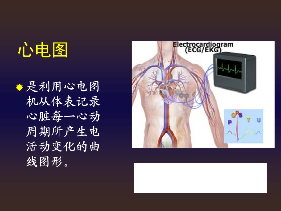 本心电图ppt课件.ppt_第3页