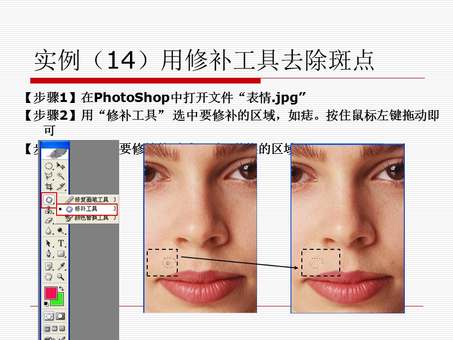 实例用修补工具去除斑点.ppt_第2页