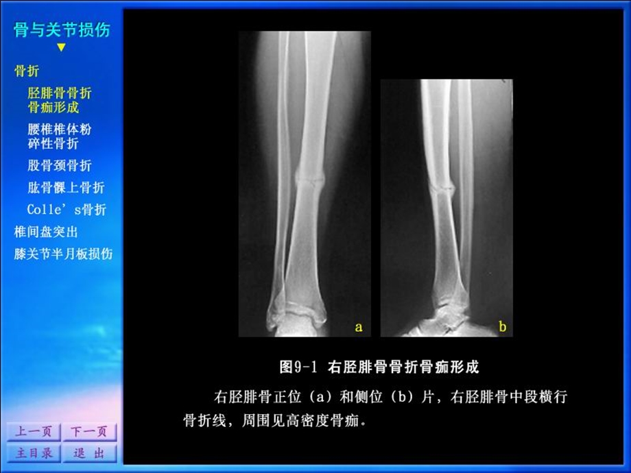 影像诊断学系列图谱骨骼系统.ppt_第2页