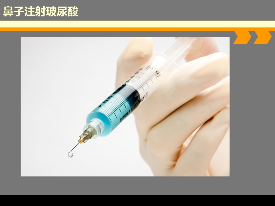 鼻子注射玻尿酸的方案.ppt_第3页