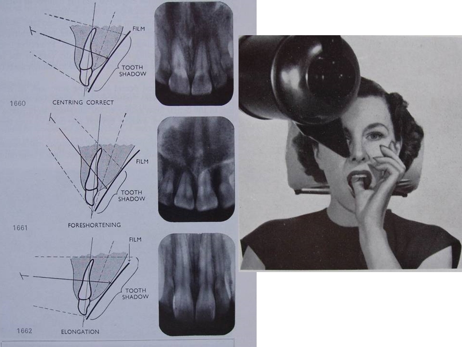 口腔颌面部及咽部影像诊断-俞安乐.ppt_第3页