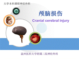 外科学-温医大-颅脑损伤.ppt