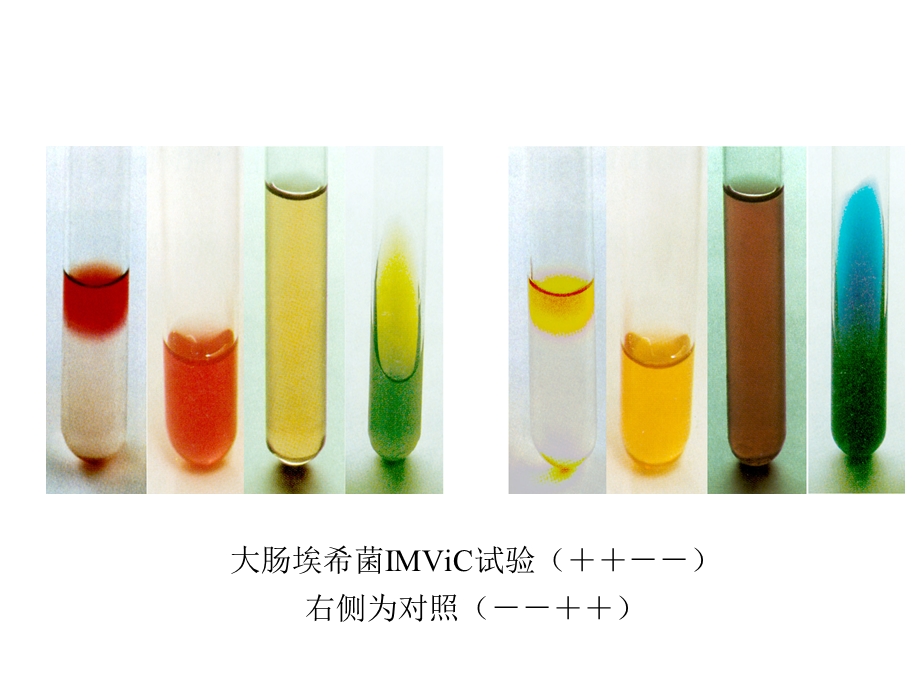 医学检验的技能操作.ppt_第3页