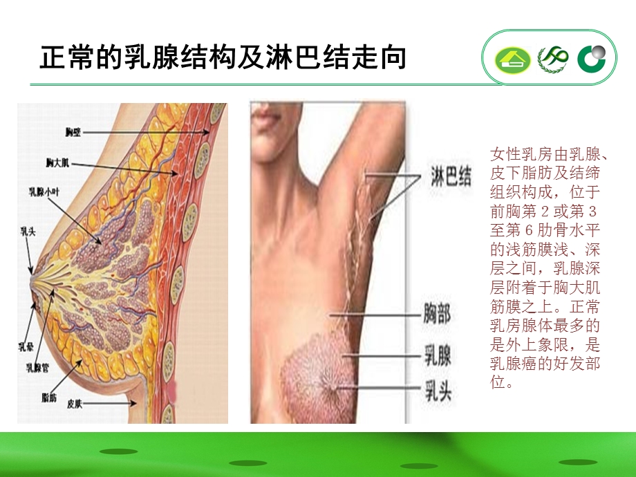 乳腺癌术后功能锻炼.ppt_第3页