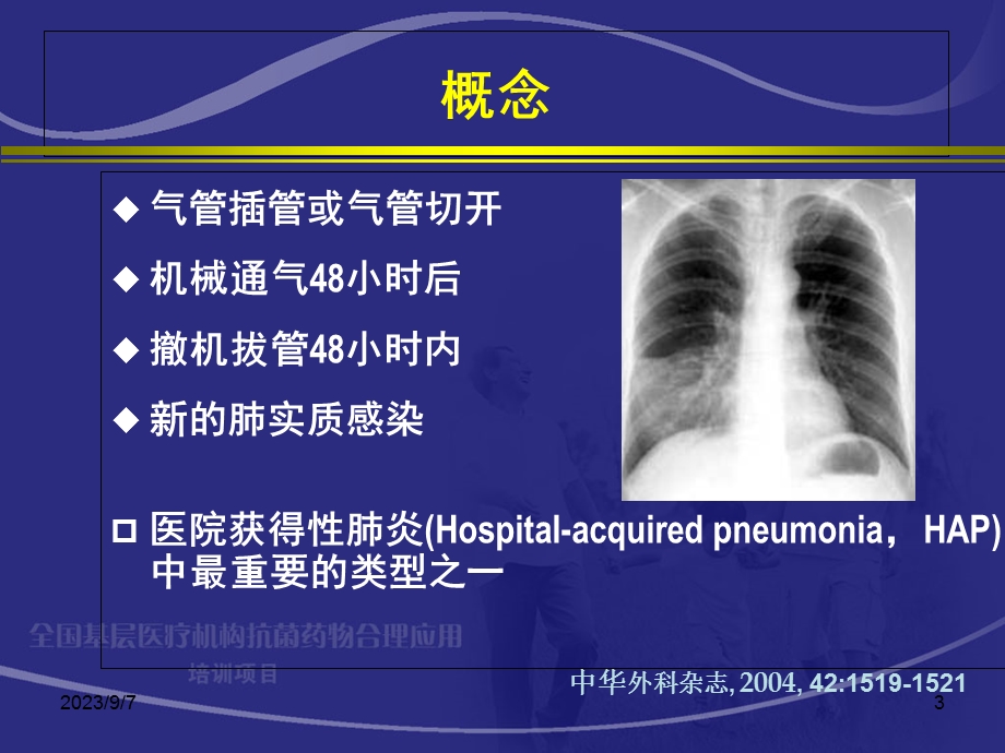 呼吸机相关性肺炎.ppt_第3页