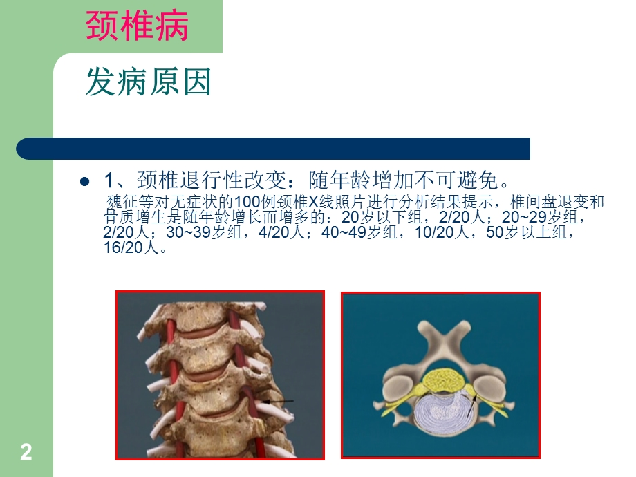 颈腰椎病的预防与自我保健.ppt_第2页