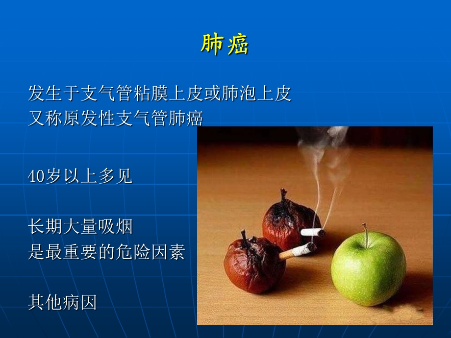 外科学教学资料-胸部肿瘤.ppt_第3页