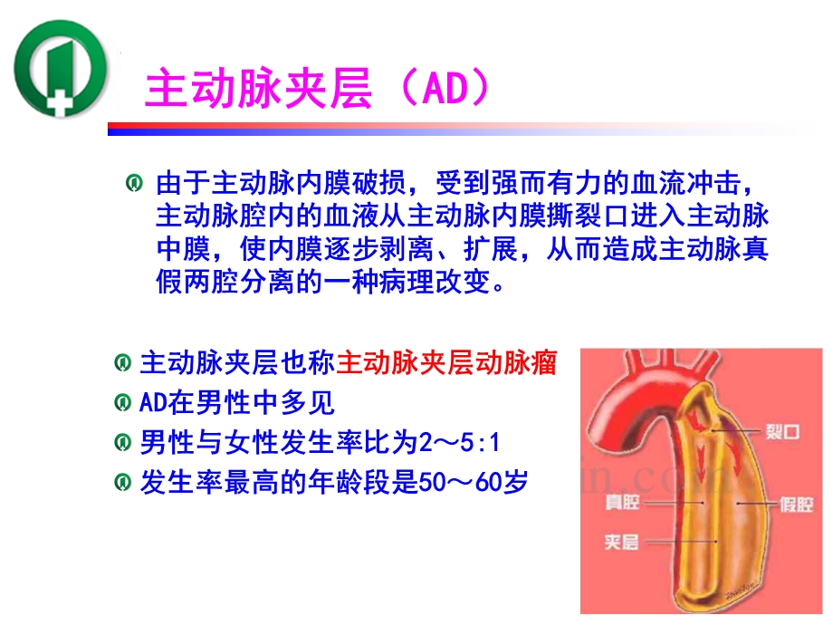 1例主动脉夹层术后患者并发肺不张的护理 ppt课件.ppt_第3页