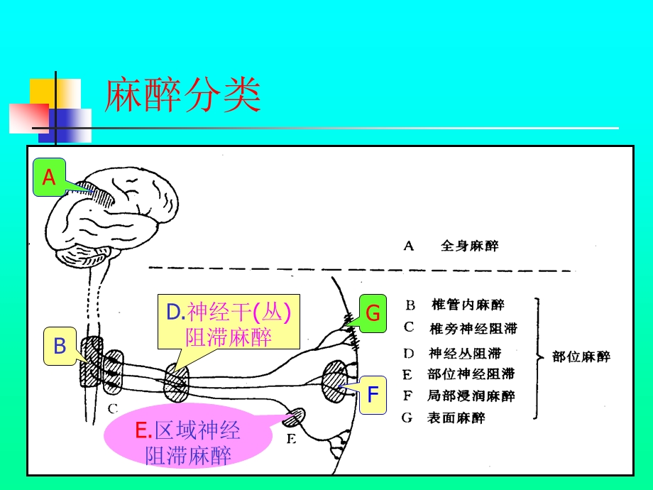 第五章 麻醉病人的护理 ppt课件.ppt_第3页