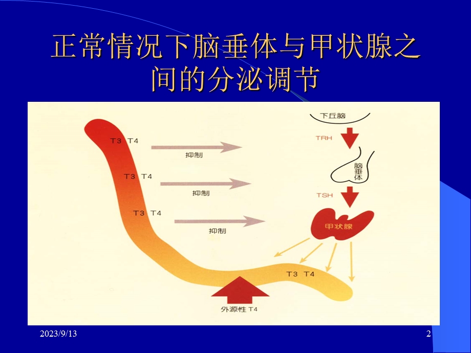 甲状腺机能亢进症下.ppt_第2页