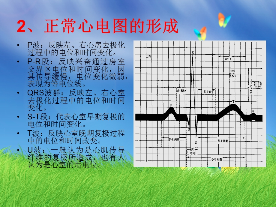 正常心电图及心律失常心电图的判读.ppt_第3页