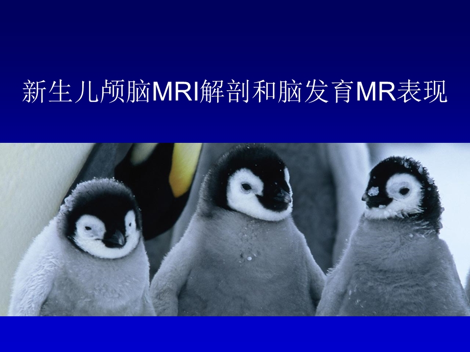 新生儿颅脑MRI讲座.ppt_第1页