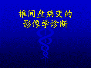 椎间盘病变影像诊断.ppt