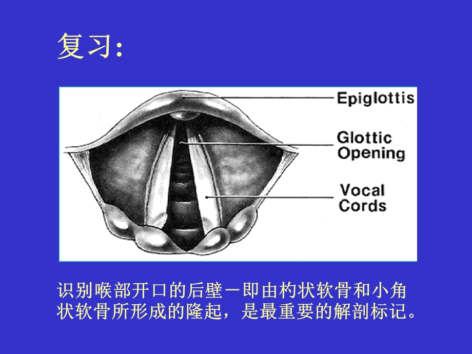 气管插管及困难气道.ppt_第2页