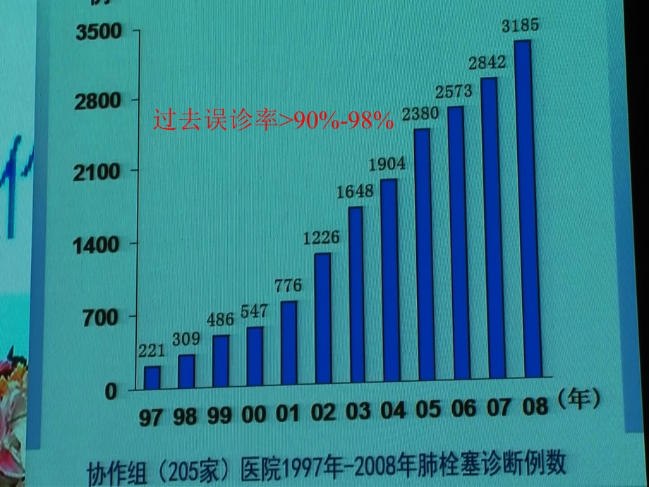 急性肺栓塞与急性冠脉综合征的鉴别.ppt_第3页