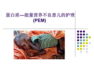 蛋白质—能量营养不良1013 ppt课件.ppt