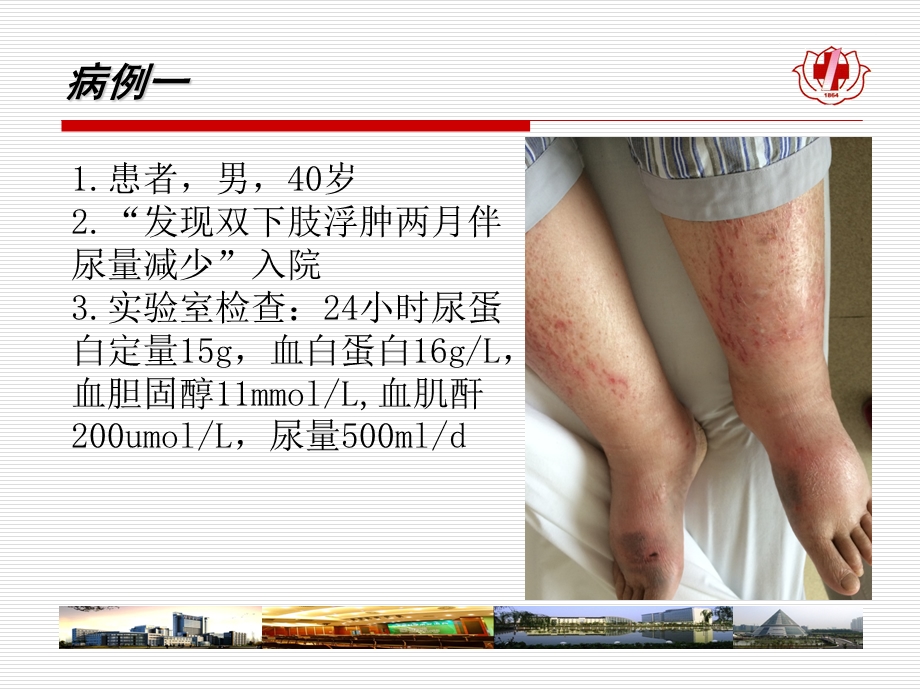 病理生理肾功能衰竭.ppt_第2页