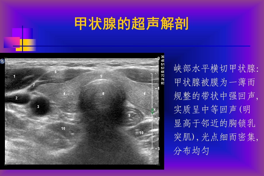 甲状腺的超声检查PPT.ppt_第3页