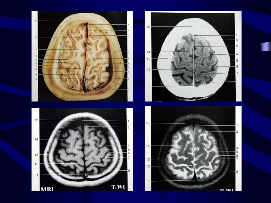 全身解剖对应CT.ppt_第3页