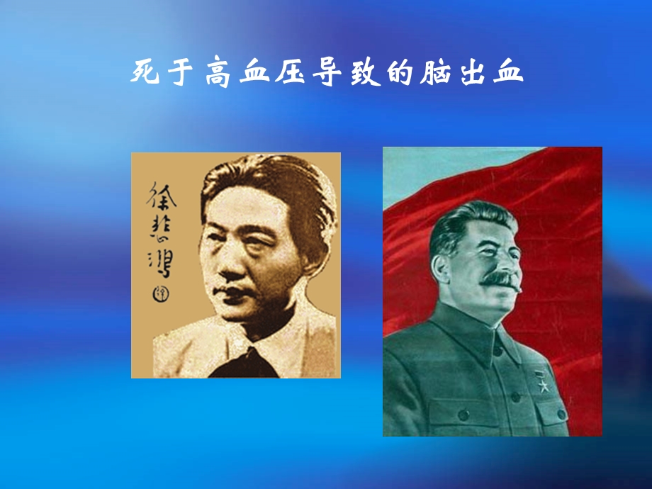 心脑血管及高血压病预防.ppt_第3页