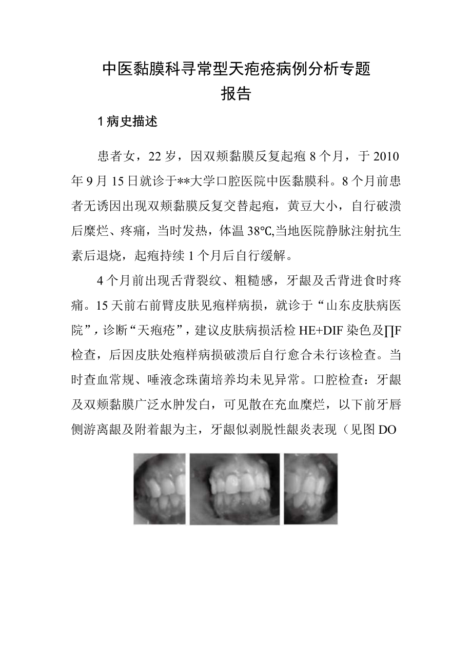 中医黏膜科寻常型天疱疮病例分析专题报告.docx_第1页