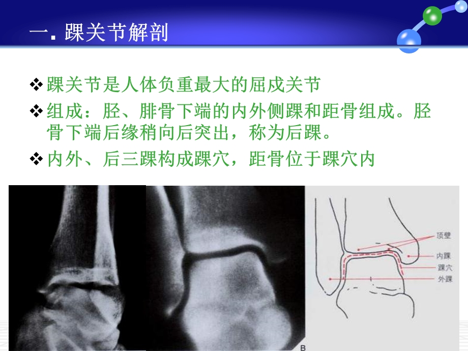 踝关节损伤Lauge-Hansen分型.ppt_第2页