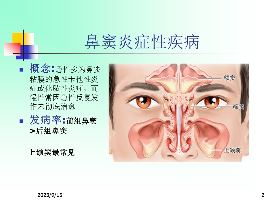 耳鼻咽喉头颈外科学二13急慢性鼻窦炎.ppt_第2页