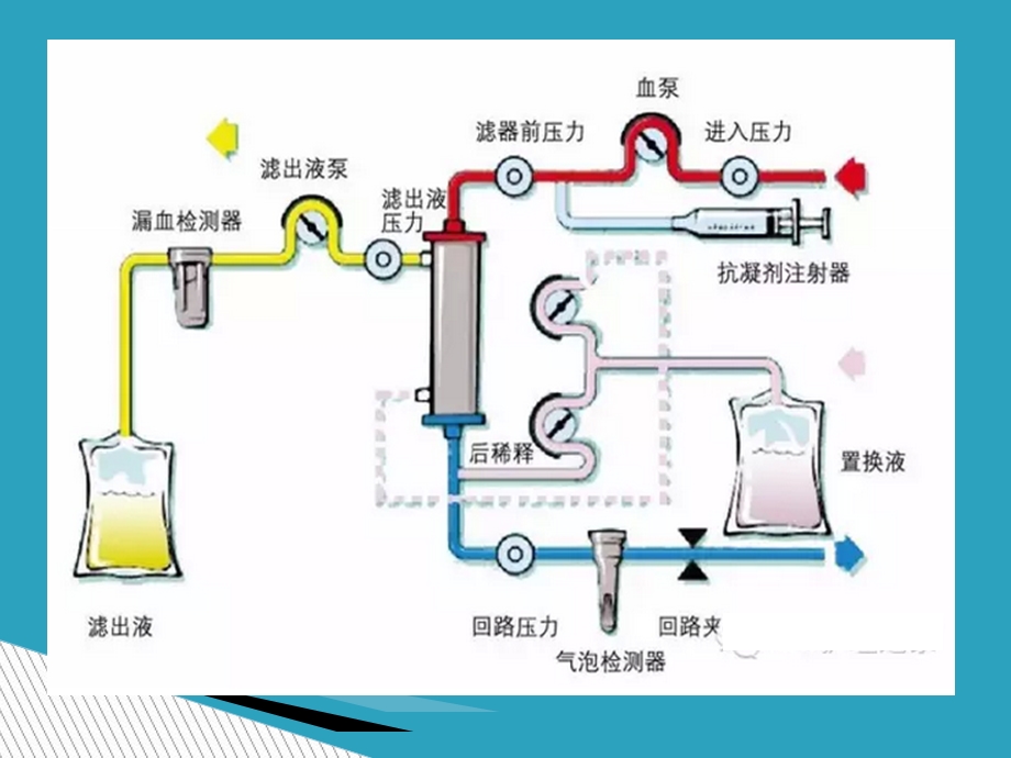 血液透析护理操作过程风险管理.ppt_第2页