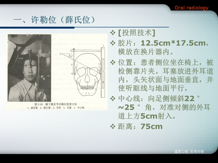 口腔影像诊断学(全)第十一章颞下颌关节疾病.ppt_第3页