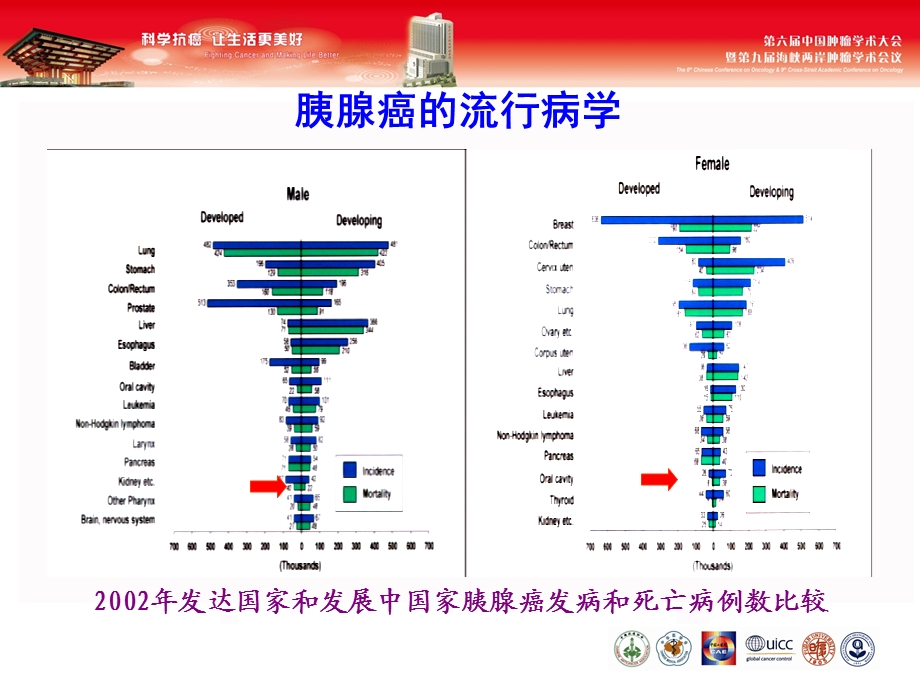 胰腺癌的诊治现状及展望.ppt_第3页