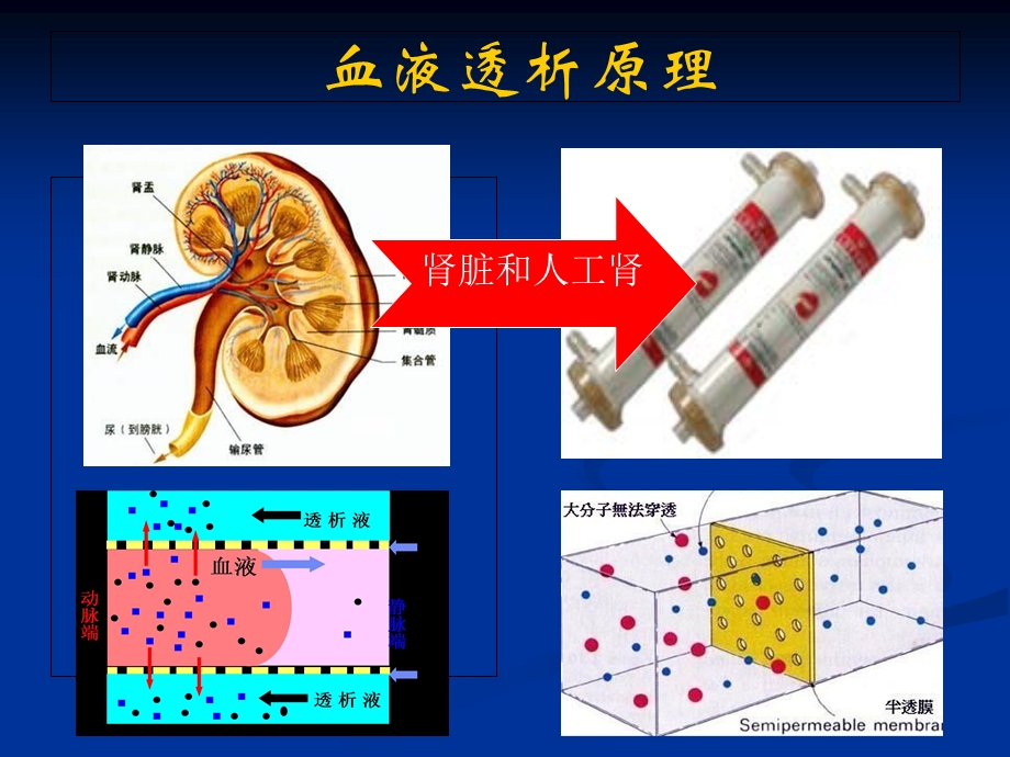 血液透析相关感染及防控.ppt_第3页