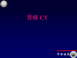 胃癌的CT诊断基本要素.ppt