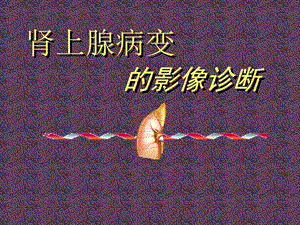 肾上腺病变的影像诊断.ppt