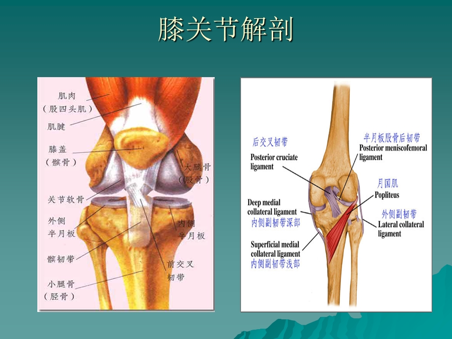 膝关节置换术后的护理.ppt_第3页