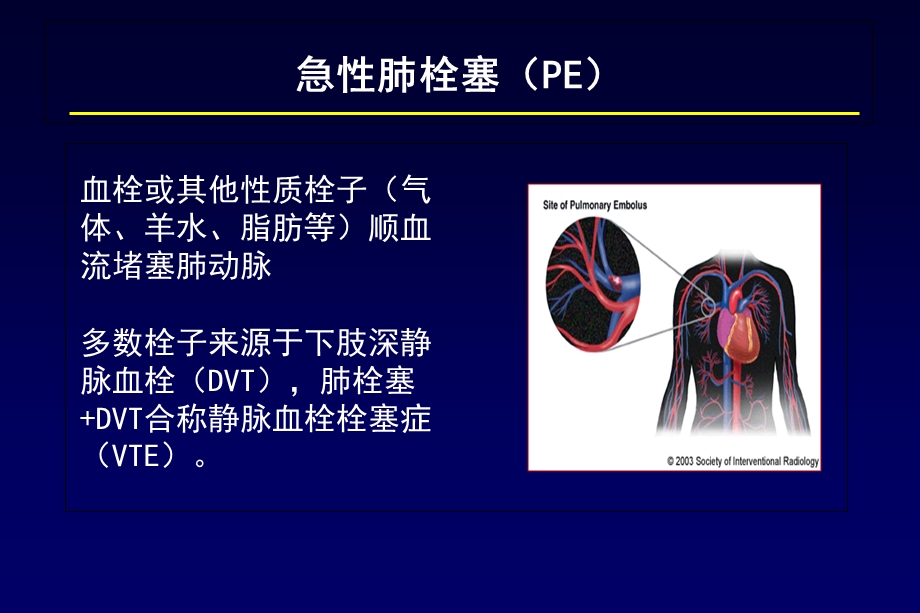 肺栓塞诊断及鉴别诊断.ppt_第2页