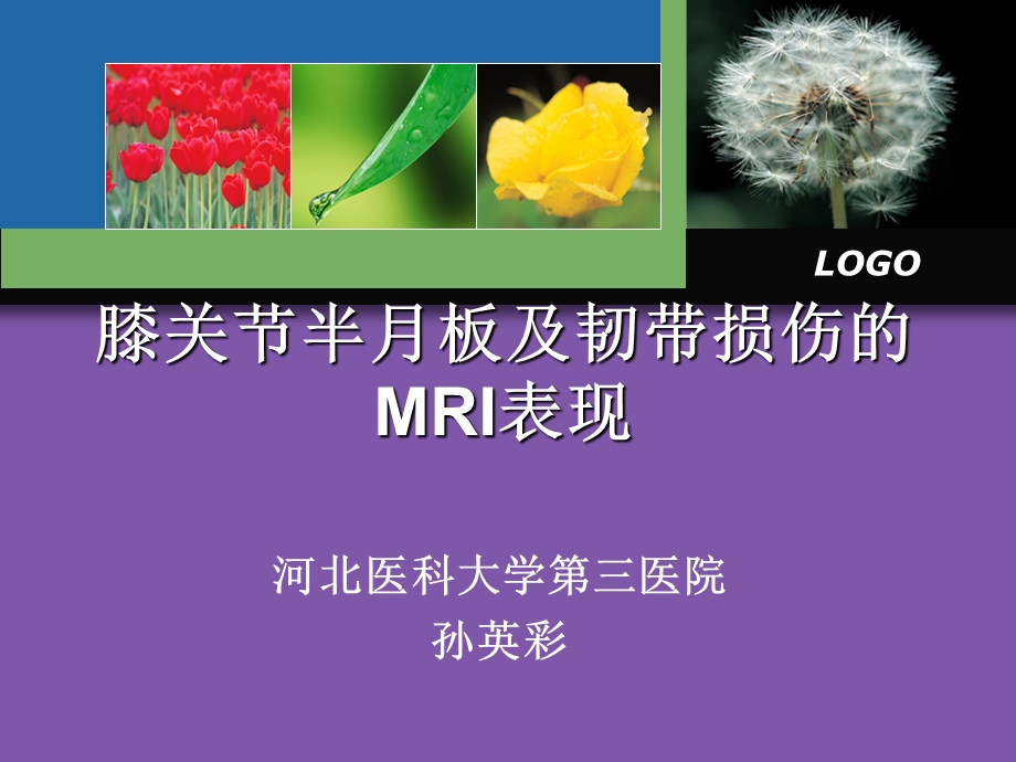 膝关节半月板及韧带损伤的MRI表现.ppt_第1页