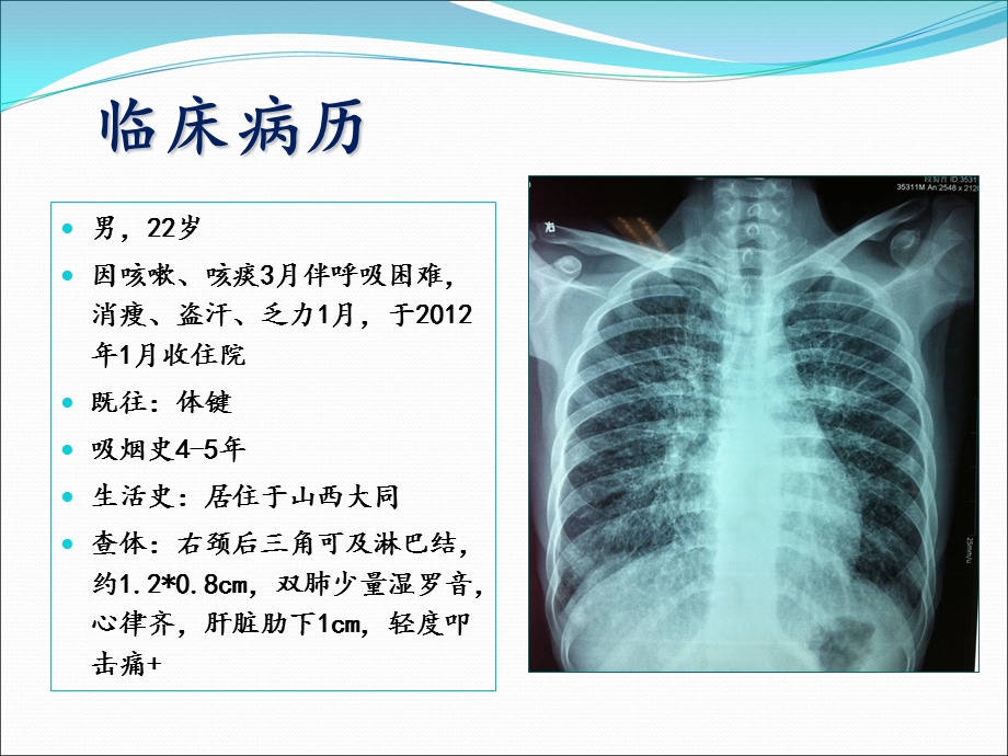 肺癌的预防和早期发现.ppt_第2页