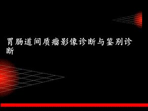 胃肠道间质瘤影像诊断与鉴别诊断上.ppt