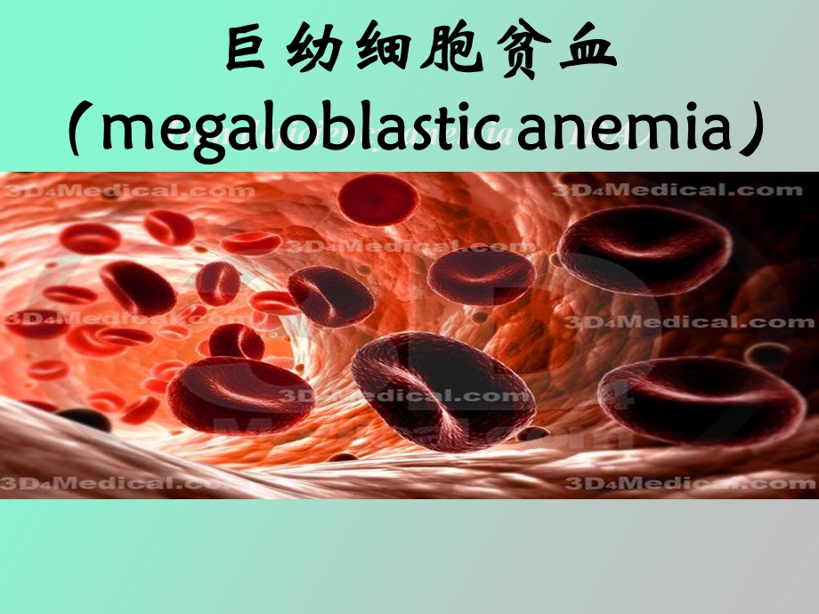 血液学巨幼细胞贫血.ppt_第1页