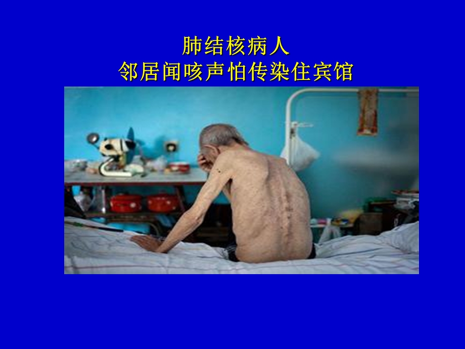 肺结核病防治知识讲座.ppt_第3页