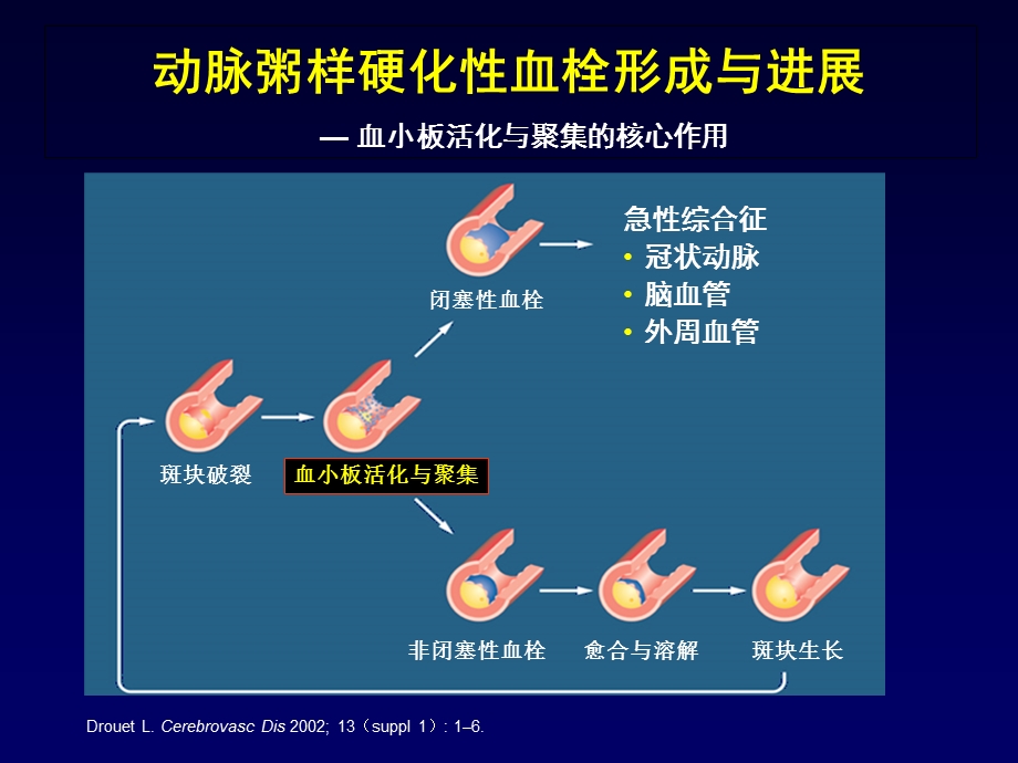 冠心病抗血小板治疗.ppt_第3页