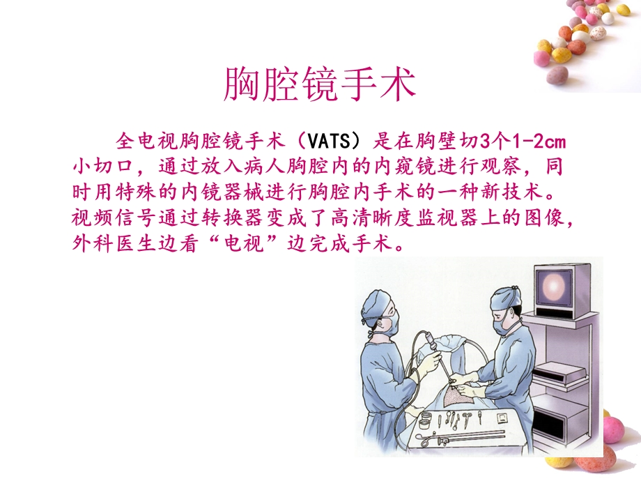 胸腔镜手术术前术后护理.ppt_第2页