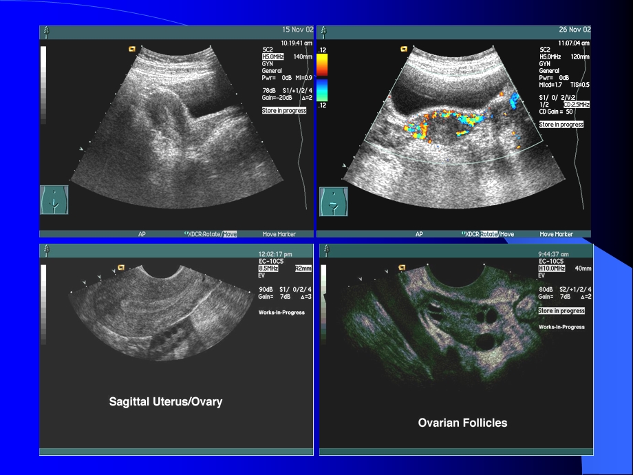 培训资料-妇产科超声检查技术.ppt_第3页
