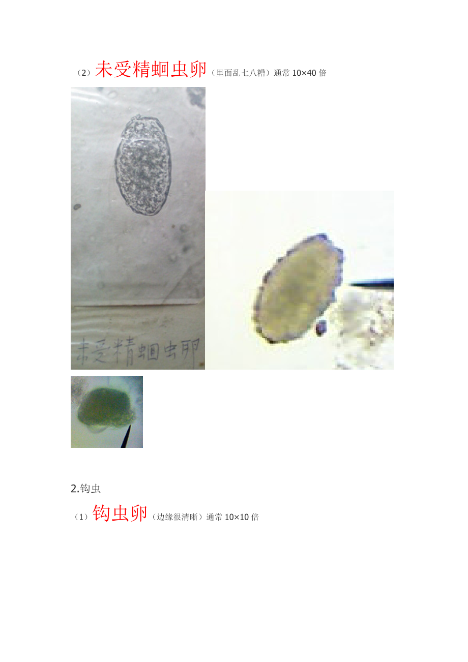 湘雅医学院寄生虫实验标本考试资料寄生虫图谱全切片标本总结.doc_第3页