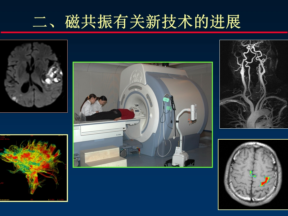 《mr进展与解剖》ppt课件.ppt_第1页