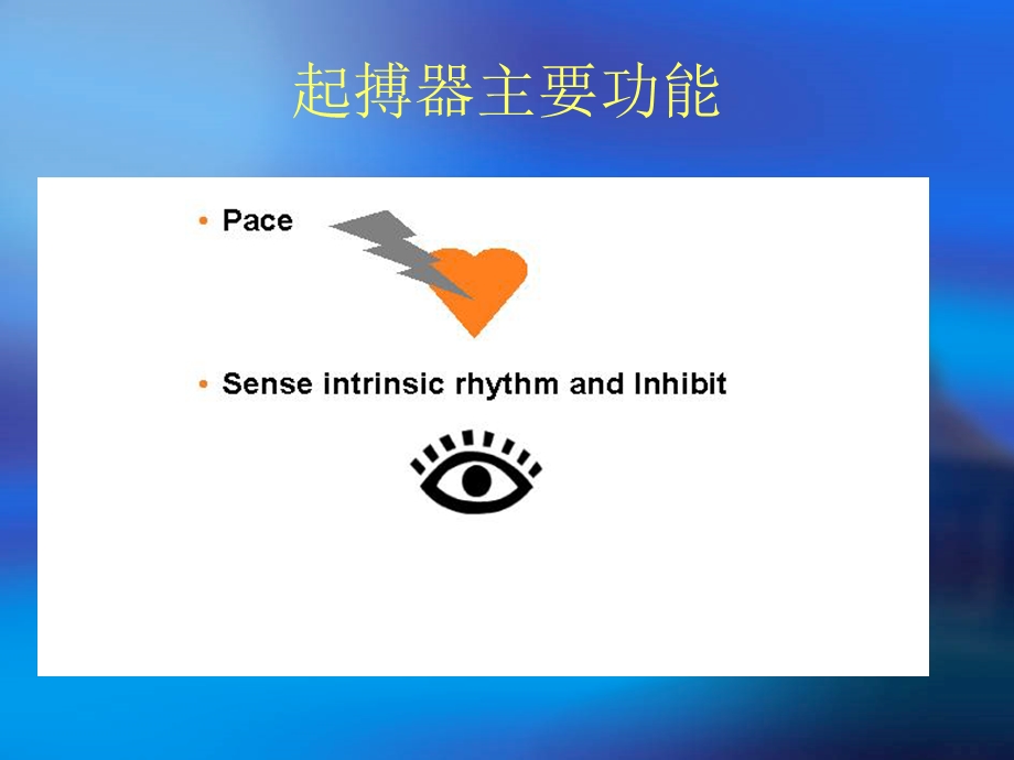 起搏器常见故障识别.ppt_第2页